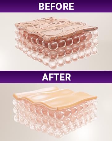 Stretch Mark Cream Prevention for Pregnancy - Maternity Cream for Stretch Marks Removal | Nourishing Formula – Prevents Stretch Marks & Improves Elasticity - 4 oz (120g) (2 Pack)