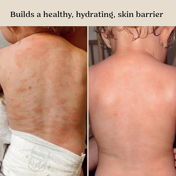 Roe Wellness- Baby Lotion Moisturizer Fragrance-Free | Great For Sensitive Skin Lightweight Moisturizing Lotion | For Babies, Infants, Kids and More