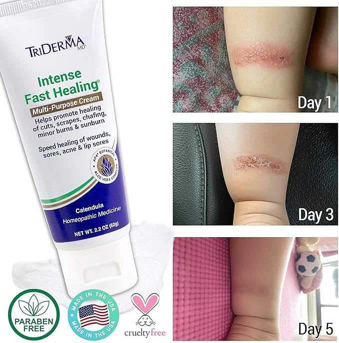 TriDerma Intense Fast Skin Healing Cream for Hard-to-Heal Skin Irritations, Sores, Rashes, Dry, Cracked Hands, Cuts, Chafing, Burns, Scrapes - First Aid Kit Essential - FSA Eligible - 2.2 oz