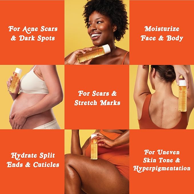 Bio-Oil Natural Skincare Oil, Serum for Scars and Stretch Marks, Face and Body Moisturizer for Dry Skin, Hair Oil, For All Skin Types, 6.7 Oz