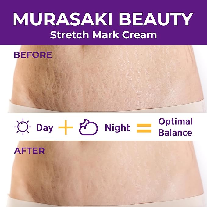 Stretch Mark Cream Prevention for Pregnancy - Maternity Cream for Stretch Marks Removal | Nourishing Formula – Prevents Stretch Marks & Improves Elasticity - 4 oz (120g) (2 Pack)