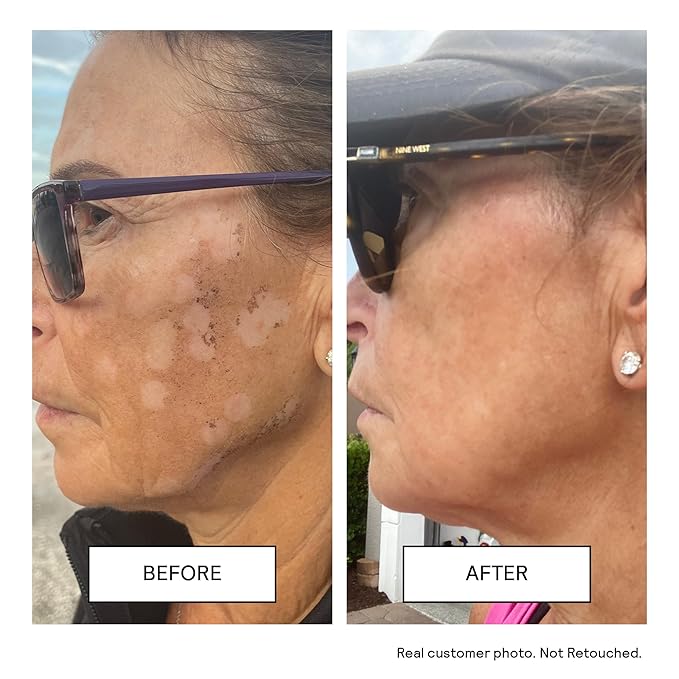 Untoxicated Moisturizing Lotion - Daily Face Moisturizer & Body Lotion for Sensitive Skin - Ceramides & Hyaluronic Acid - No Common Irritants - Non-Comedogenic - Oil-Free - Fragrance Free - 10 Ounce