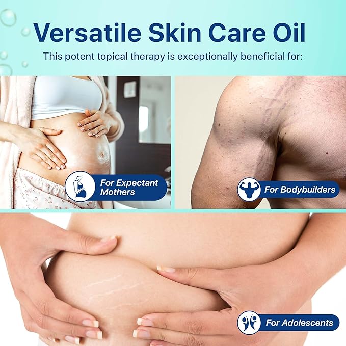 Stretch Mark Oil, Minimizes the Risk and Severity of Stretch Marks, Gentle Belly Oil for Pregnancy, Made of Natural Ingredients, Suitable for Adults and Children, 120mL（4.06 Fl Oz）