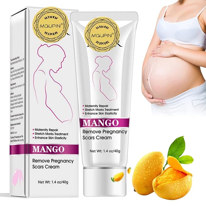 RtopR Mango Stretch Marks and Scar Cream -Stretch Marks and Scar Removal Cream for Pregnancy - Best Body Moisturizer-40g