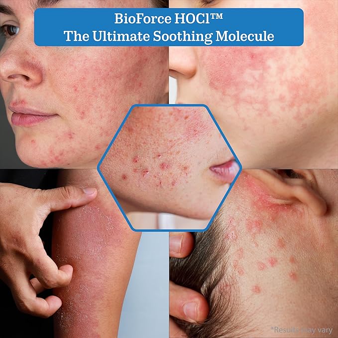 BioForce HOCl Pure Hypochlorous Acid Spray Refill for Face & Body (33 Oz) - Acne-Prone Skin & Eczema, Piercing aftercare, Made in Canada, Gentle Skin Cleanser & Toner, pH Balanced, Non-comedogenic