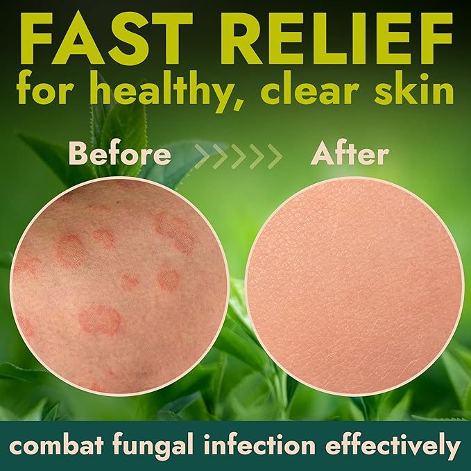 Body Wipes for Men & Women | Cleansing Body Wipes for Wrestling, Combat, Gym, Camping I Medicated with 1% Tolnaftate, Tea Tree Oil | Treats Ringworm, Jock Itch, Athlete's Foot | 40 Wipes