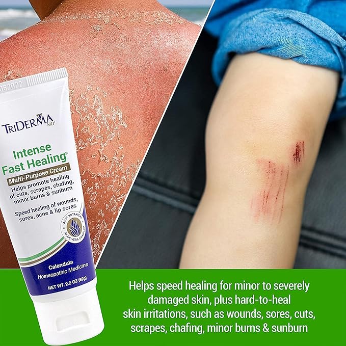 TriDerma Intense Fast Skin Healing Cream for Hard-to-Heal Skin Irritations, Sores, Rashes, Dry, Cracked Hands, Cuts, Chafing, Burns, Scrapes - First Aid Kit Essential - FSA Eligible - 2.2 oz