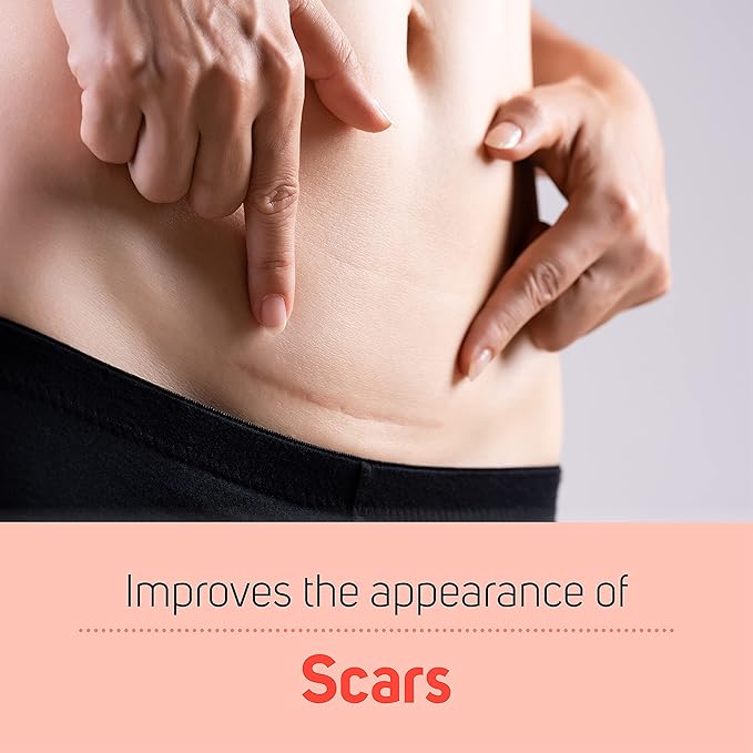 Care Science Natural Skin Care Body Oil Serum For Scars and Stretch Marks | Face and Body Moisturizer | Hair, Anti Aging, Dehydrated Skin, C Section Recovery | Vitamin E, Olive Oil, Coconut Oil, 5 Oz