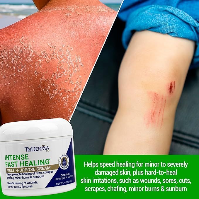 TriDerma Intense Fast Healing Cream, Decreases Healing Time for Minor Irritations, Rashes, Scrapes, Cuts 4 Ounces